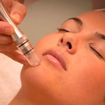 Microdermabrasion Thousand Oaks, CA.